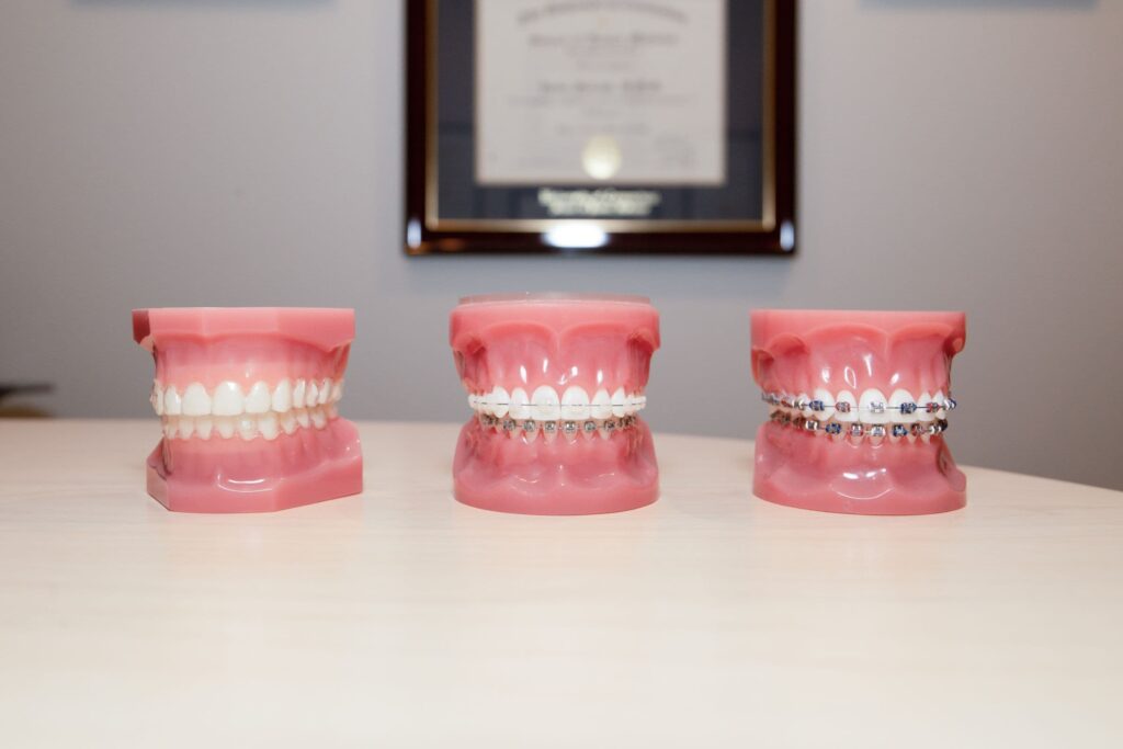 Ceramic Braces: Ancient Origins, Bright Future! - Sunbury Dental House